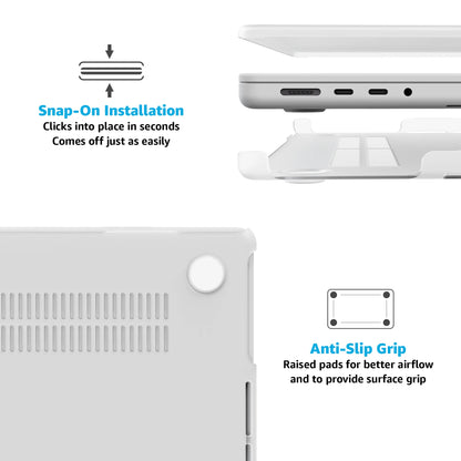 Perfect Stripes | Pink Stripes Laptop Shell